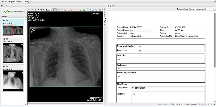photo Teleradiology edition